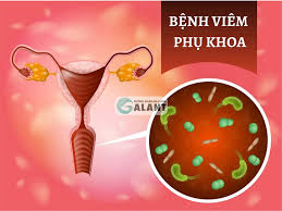 KHÁM PHỤ KHOA- ĐIỀU TRỊ CÁC BỆNH LÝ VIÊM NHIỄM PHỤ KHOA